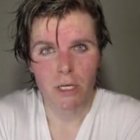 Onision