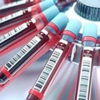 US Government Created AIDS/HIV