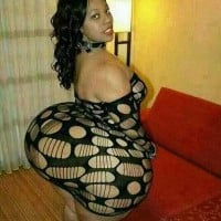 Buttock Augmentation